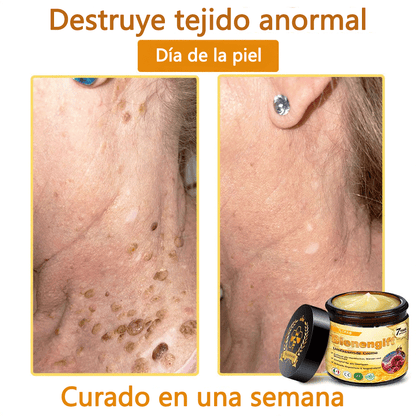 🎁 Crema TLOPA® con complejo de veneno de abeja: antienvejecimiento, hidratante, reparadora de la piel, mejora la textura de la piel, trata el acné y la pigmentación, elimina verrugas y lunares y alivia la psoriasis.