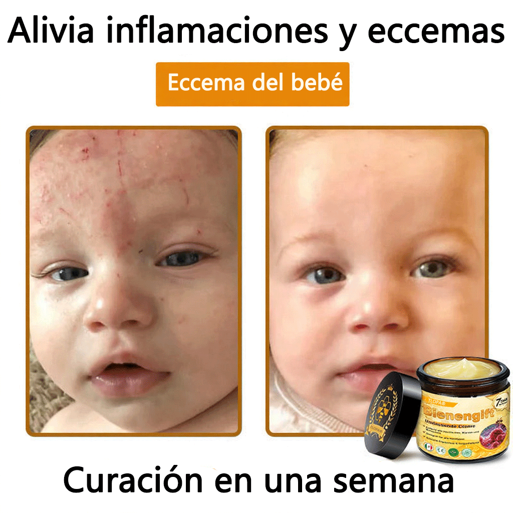 🎁 Crema TLOPA® con complejo de veneno de abeja: antienvejecimiento, hidratante, reparadora de la piel, mejora la textura de la piel, trata el acné y la pigmentación, elimina verrugas y lunares y alivia la psoriasis.