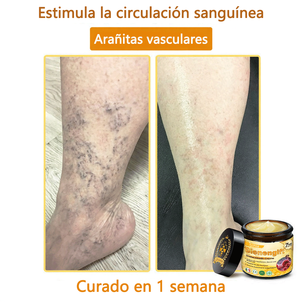 🎁 Crema TLOPA® con complejo de veneno de abeja: antienvejecimiento, hidratante, reparadora de la piel, mejora la textura de la piel, trata el acné y la pigmentación, elimina verrugas y lunares y alivia la psoriasis.