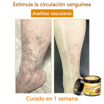 🎁 Crema TLOPA® con complejo de veneno de abeja: antienvejecimiento, hidratante, reparadora de la piel, mejora la textura de la piel, trata el acné y la pigmentación, elimina verrugas y lunares y alivia la psoriasis.