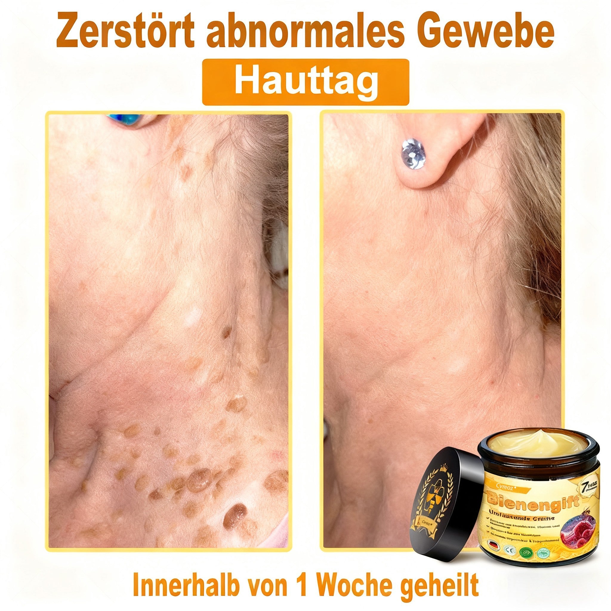 2 Dosen （🌤️ Aufhellen & Ebenmäßigkeit）🎁1 kaufen*1 gratis– doppelte Wirkung für sichtbar strahlendere Haut; Unebenheiten werden nach und nach gemildert.✨