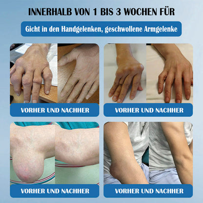 𝖯𝗂cpii BPC-157 Gelenks-Heilcreme🦴Behandelt Arthritis, Neuropathie, Rheumatismus, Sportverletzungen & mehr👍