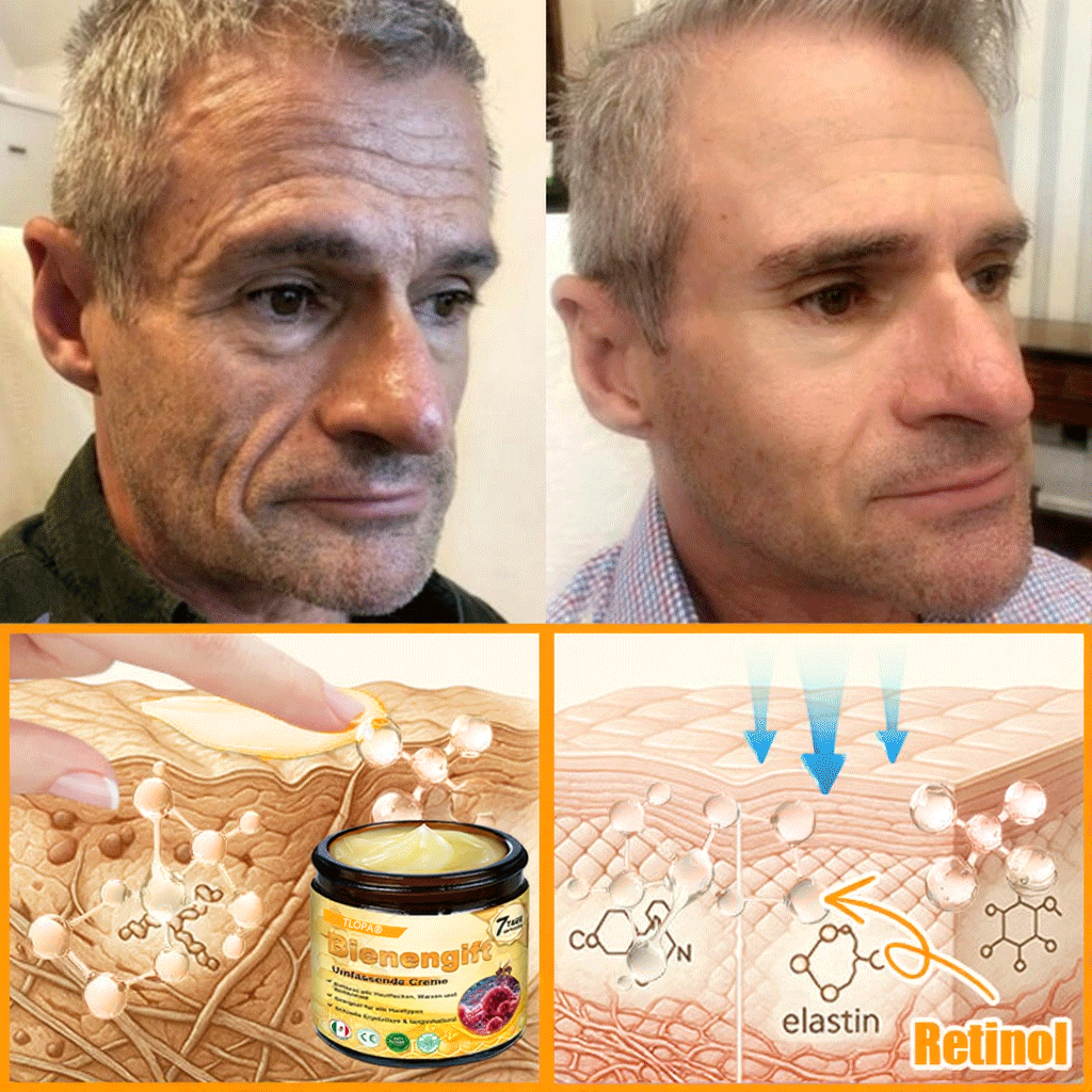 🎁 Crema TLOPA® con complejo de veneno de abeja: antienvejecimiento, hidratante, reparadora de la piel, mejora la textura de la piel, trata el acné y la pigmentación, elimina verrugas y lunares y alivia la psoriasis.