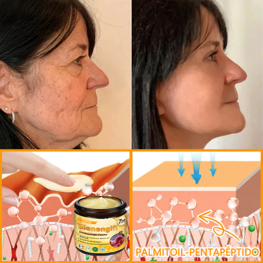 🎁 Crema TLOPA® con complejo de veneno de abeja: antienvejecimiento, hidratante, reparadora de la piel, mejora la textura de la piel, trata el acné y la pigmentación, elimina verrugas y lunares y alivia la psoriasis.