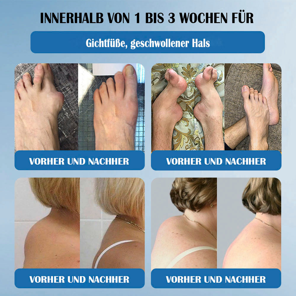 𝖯𝗂cpii BPC-157 Gelenks-Heilcreme🦴Behandelt Arthritis, Neuropathie, Rheumatismus, Sportverletzungen & mehr👍