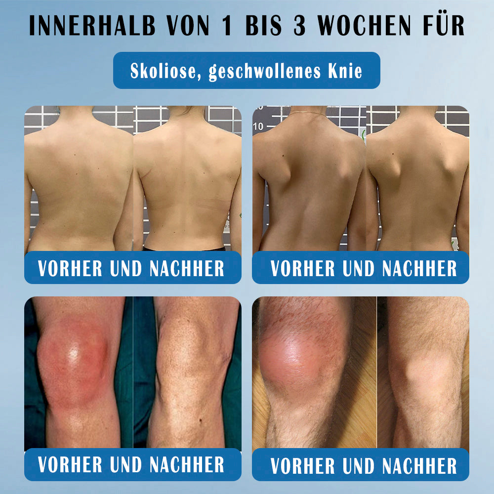 𝖯𝗂cpii BPC-157 Gelenks-Heilcreme🦴Behandelt Arthritis, Neuropathie, Rheumatismus, Sportverletzungen & mehr👍