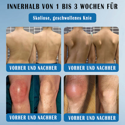 𝖯𝗂cpii BPC-157 Gelenks-Heilcreme🦴Behandelt Arthritis, Neuropathie, Rheumatismus, Sportverletzungen & mehr👍